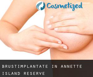 Brustimplantate in Annette Island Reserve