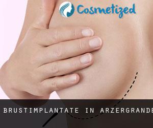 Brustimplantate in Arzergrande