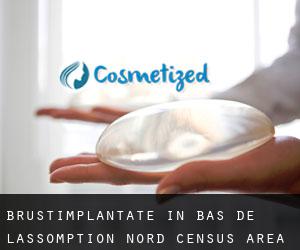 Brustimplantate in Bas-de-L'Assomption-Nord (census area)