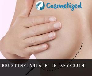 Brustimplantate in Beyrouth Brustimplantate in Beyrouth