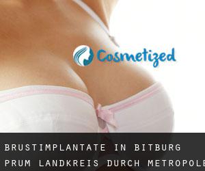 Brustimplantate in Bitburg-Prüm Landkreis durch metropole - Seite 1