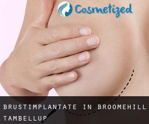 Brustimplantate in Broomehill-Tambellup