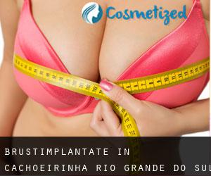 Brustimplantate in Cachoeirinha (Rio Grande do Sul)