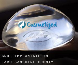 Brustimplantate in Cardiganshire County