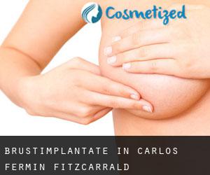 Brustimplantate in Carlos Fermin Fitzcarrald