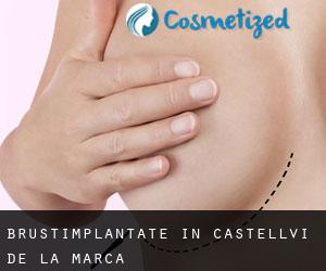 Brustimplantate in Castellví de la Marca