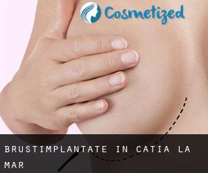 Brustimplantate in Catia La Mar