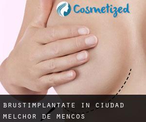 Brustimplantate in Ciudad Melchor de Mencos