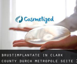 Brustimplantate in Clark County durch metropole - Seite 1