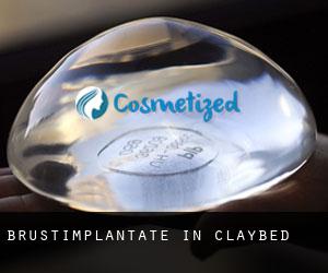 Brustimplantate in Claybed