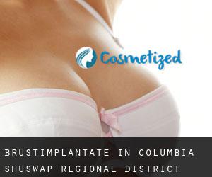 Brustimplantate in Columbia-Shuswap Regional District