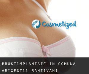Brustimplantate in Comuna Ariceştii-Rahtivani