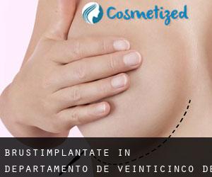 Brustimplantate in Departamento de Veinticinco de Mayo (Misiones)