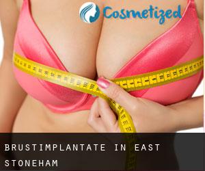 Brustimplantate in East Stoneham