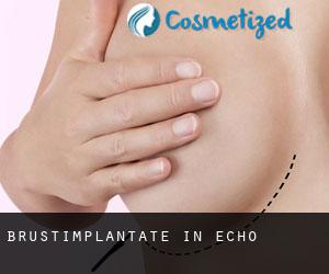 Brustimplantate in Echo