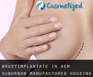 Brustimplantate in Gem Suburban Manufactured Housing Community