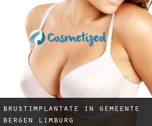 Brustimplantate in Gemeente Bergen (Limburg)