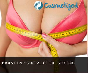Brustimplantate in Goyang