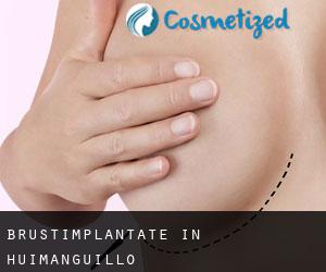 Brustimplantate in Huimanguillo