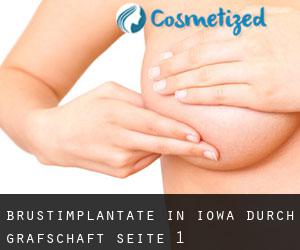 Brustimplantate in Iowa durch Grafschaft - Seite 1