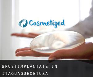 Brustimplantate in Itaquaquecetuba