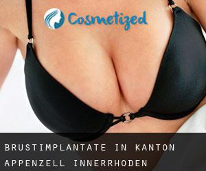 Brustimplantate in Kanton Appenzell Innerrhoden