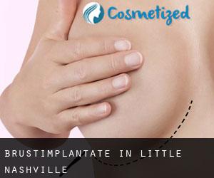 Brustimplantate in Little Nashville