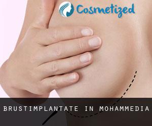 Brustimplantate in Mohammedia