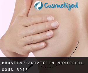 Brustimplantate in Montreuil-sous-Bois
