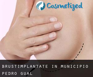 Brustimplantate in Municipio Pedro Gual