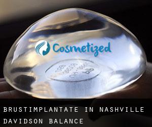 Brustimplantate in Nashville-Davidson (balance)
