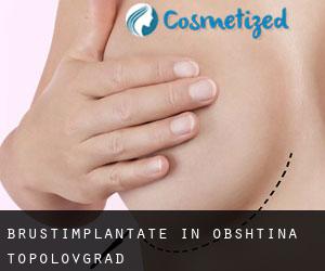 Brustimplantate in Obshtina Topolovgrad