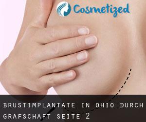 Brustimplantate in Ohio durch Grafschaft - Seite 2