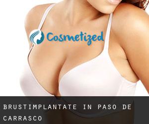 Brustimplantate in Paso de Carrasco