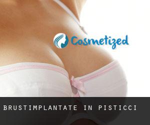 Brustimplantate in Pisticci