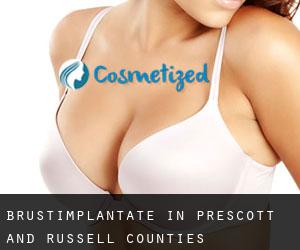 Brustimplantate in Prescott and Russell Counties