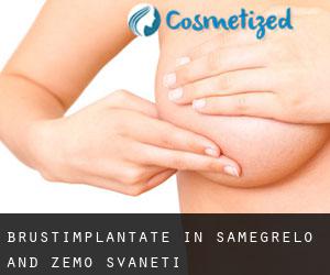 Brustimplantate in Samegrelo and Zemo Svaneti