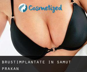 Brustimplantate in Samut Prakan Brustimplantate in Samut Prakan