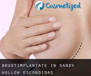 Brustimplantate in Sandy Hollow-Escondidas