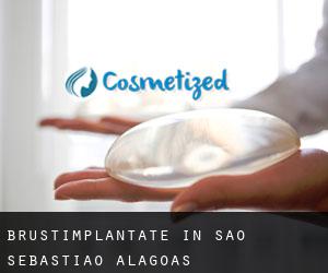 Brustimplantate in São Sebastião (Alagoas)