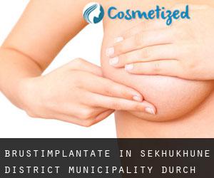 Brustimplantate in Sekhukhune District Municipality durch hauptstadt - Seite 1