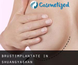 Brustimplantate in Shuangyashan