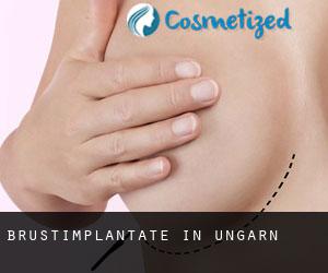 Brustimplantate in Ungarn Brustimplantate in Ungarn