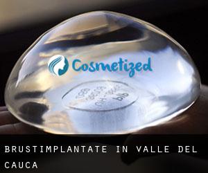 Brustimplantate in Valle del Cauca Brustimplantate in Valle del Cauca