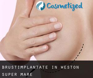 Brustimplantate in Weston-super-Mare