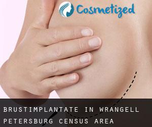 Brustimplantate in Wrangell-Petersburg Census Area