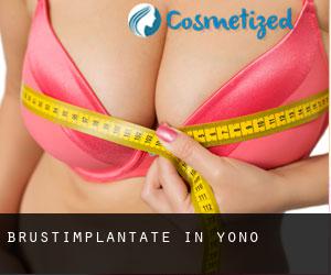 Brustimplantate in Yono