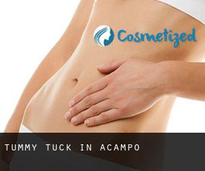 Tummy Tuck in Acampo