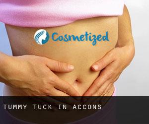 Tummy Tuck in Accons