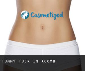 Tummy Tuck in Acomb